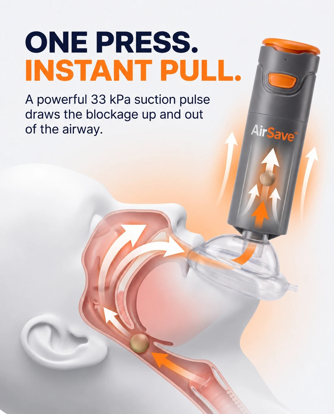 One press, instant pull: a 33 kPa suction pulse draws the blockage out of the airway